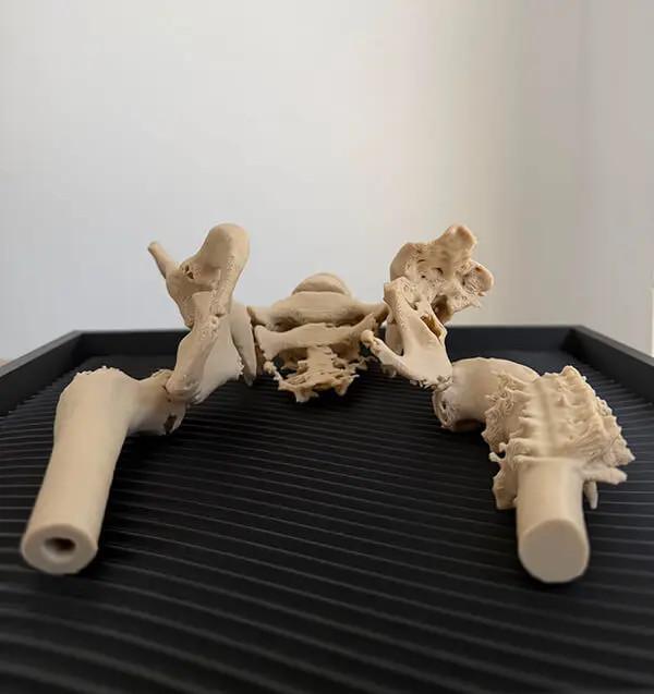 3D Printing Complex Bones to Assist in Orthopedic Preoperative Planning! Ultra-Detailed!